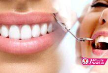 4 tips to keep away dental problems