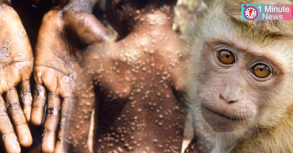 monkey pox speared may grow fast alart by 'who'