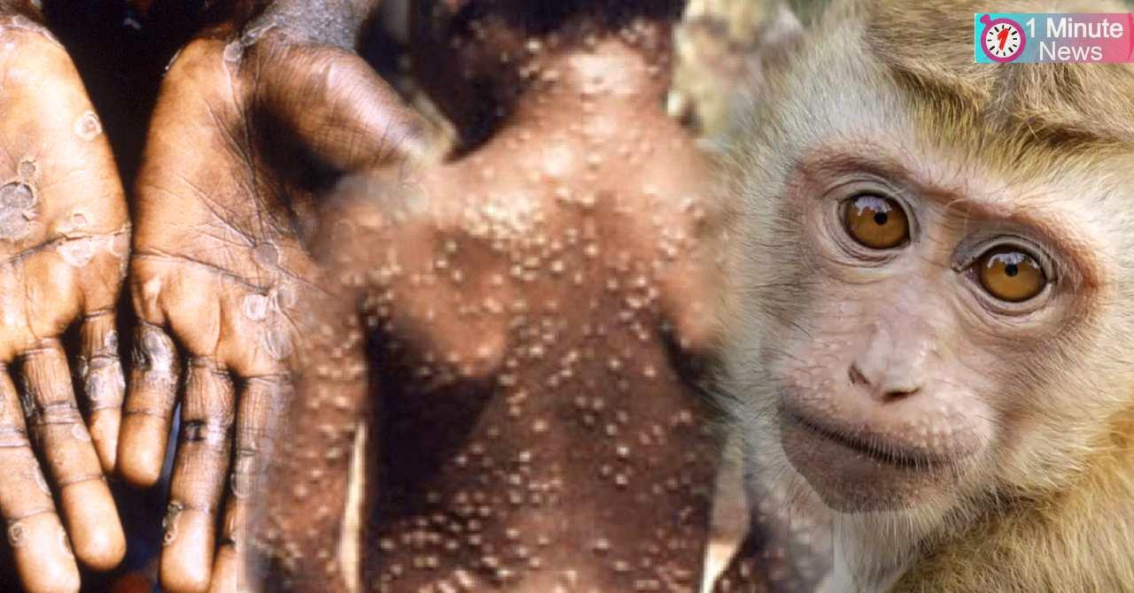 monkey pox speared may grow fast alart by 'who'